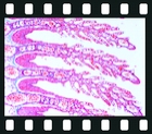 Respiratory system, 17 projection slides