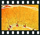 Nervous system, 25 projection slides