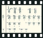 Human Genetics Part I. Modes of inheritance, 34 projection slides