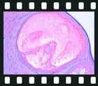 Reproductive system, 24 projection slides