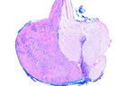 Hypophysis (pituitary body) sagittal l.s. with adeno- and neurohypophysis