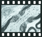 Electron Micrographs of Animal Cells and Tissues, 29 projection slides