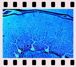 Nervous system, 25 projection slides