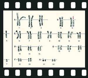 Human Genetics Part I. Modes of inheritance, 34 projection slides