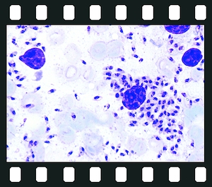 Protozoa, 35 projection slides