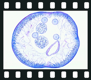 Nemathelminthes, 23 projection slides