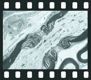 Electron Micrographs of Animal Cells and Tissues, 29 projection slides